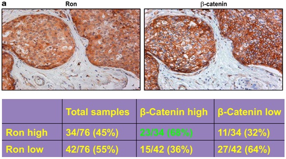 waltz_research_focus_breast_cancer