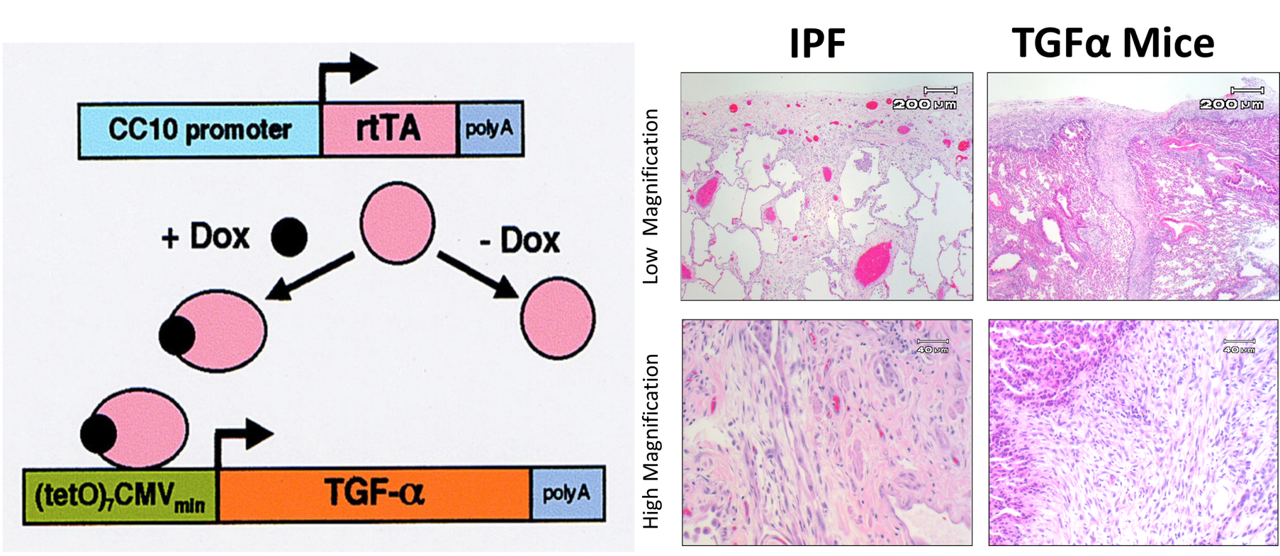 Fibrosis Model Image of Fibrosis Model