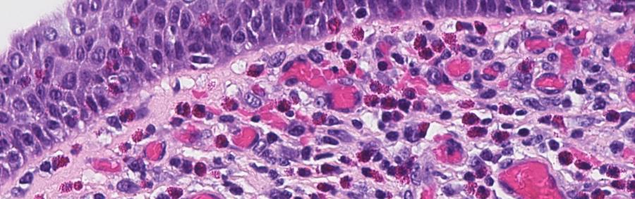 zimmer-hero slide of a cell